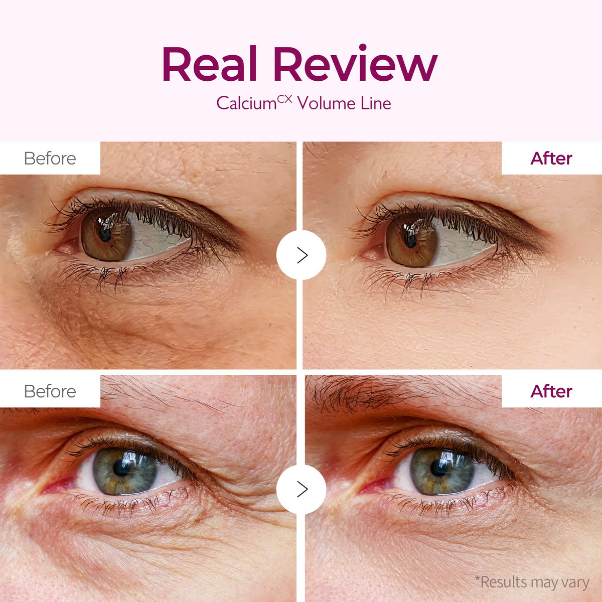 Dr. Melaxin Calcium Cemenrete Calcium Volume Eye Patch 60Patches