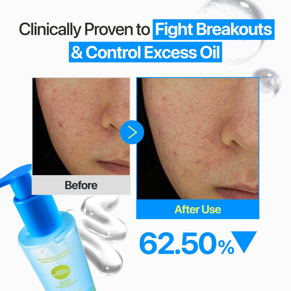 Numbuzin No.0 Zero Blemish Oil-Free Micellar Cleansing Jelly 200Ml