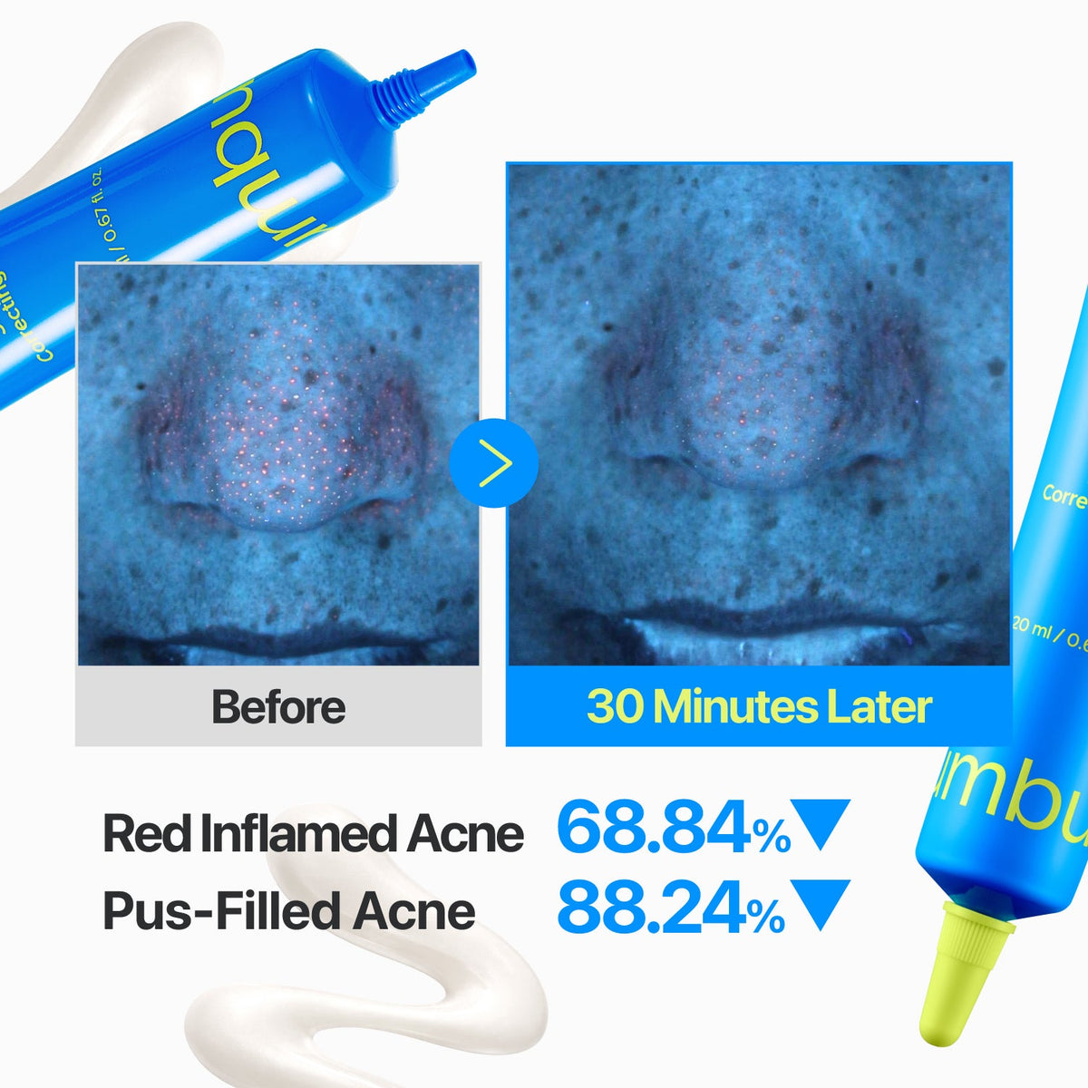 Numbuzin No.0 Zero Blemish 3X Spot Correcting Cream 20Ml