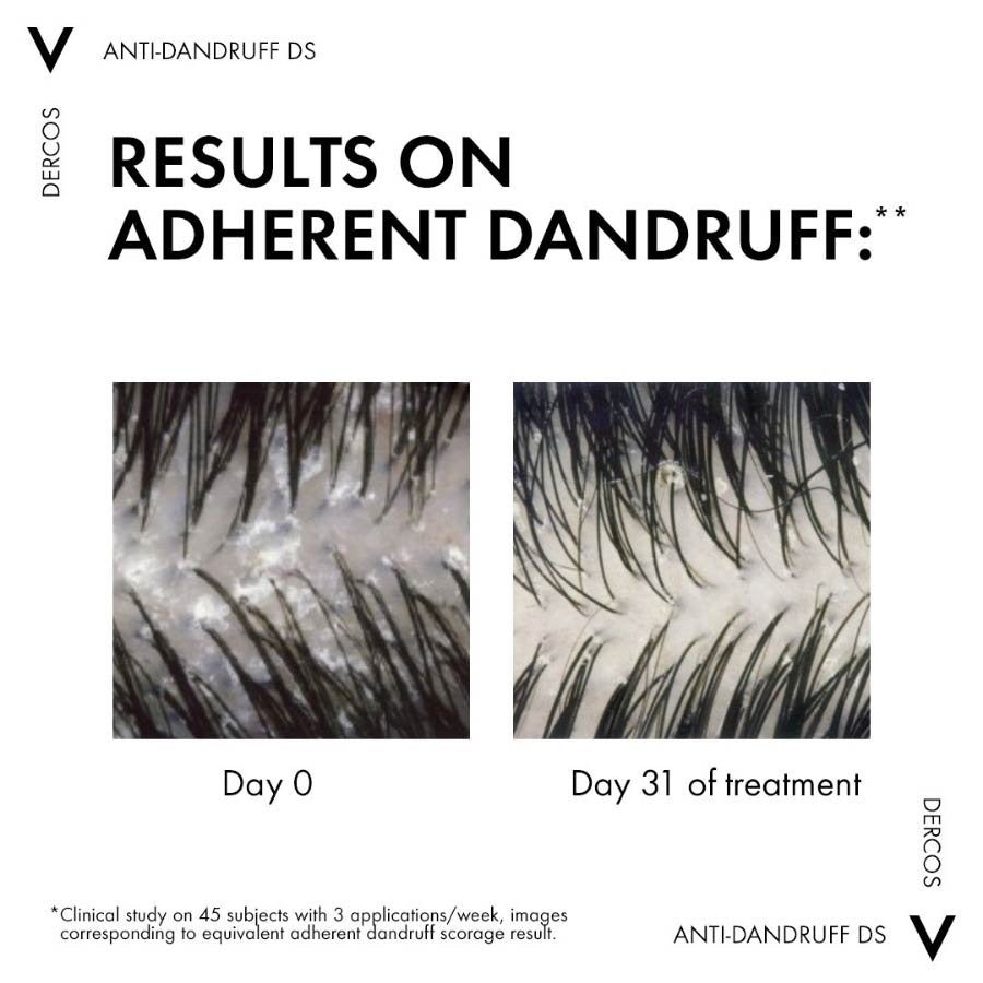 Vichy Dercos Anti-Dandruff Shampoo for Oily Hair 200Ml