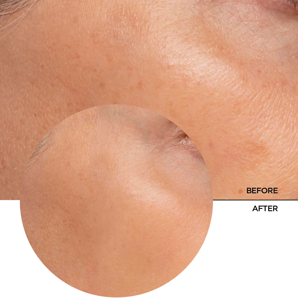 Revox B77 Just Alpha Arbutin 2% + HA Brightening Serum 30Ml