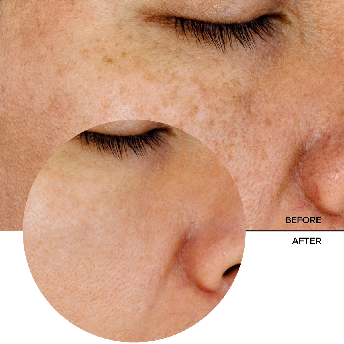 Revox B77 Just Glycolic Acid 7% Exfoliating Toner 250Ml