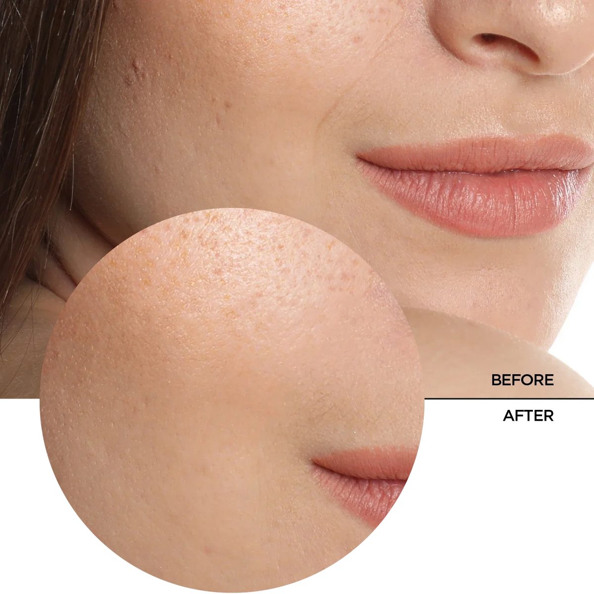 Revox B77 Just Hyaluronic Acid 5% Hydrating Fluid 30Ml