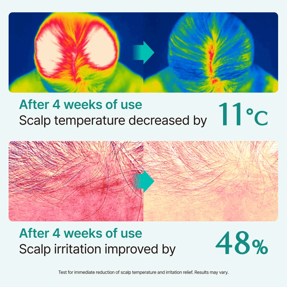 Lilyeve Scalp:Turn Cica PDRN Brush Ampoule 100Ml