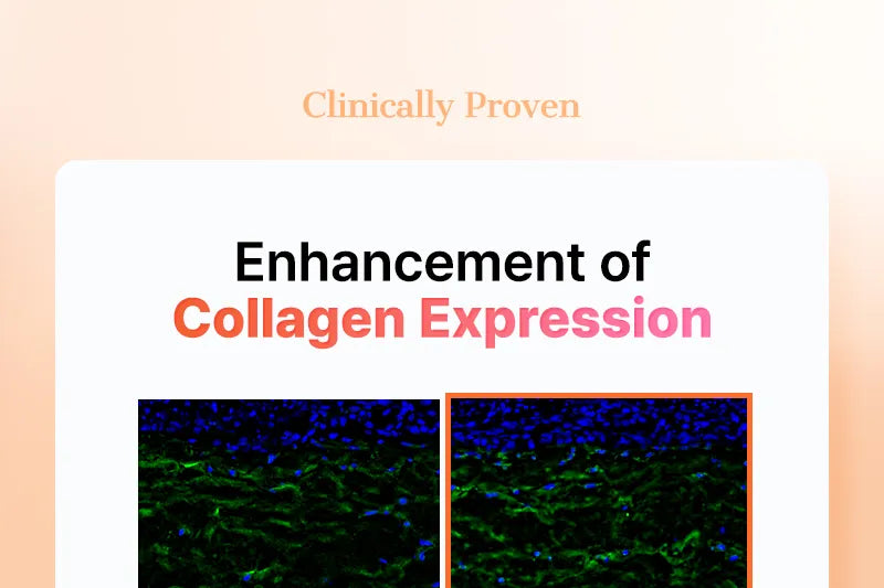 Cosrx 5 PDRN Collagen Intense Vitalizing Serum 100Ml