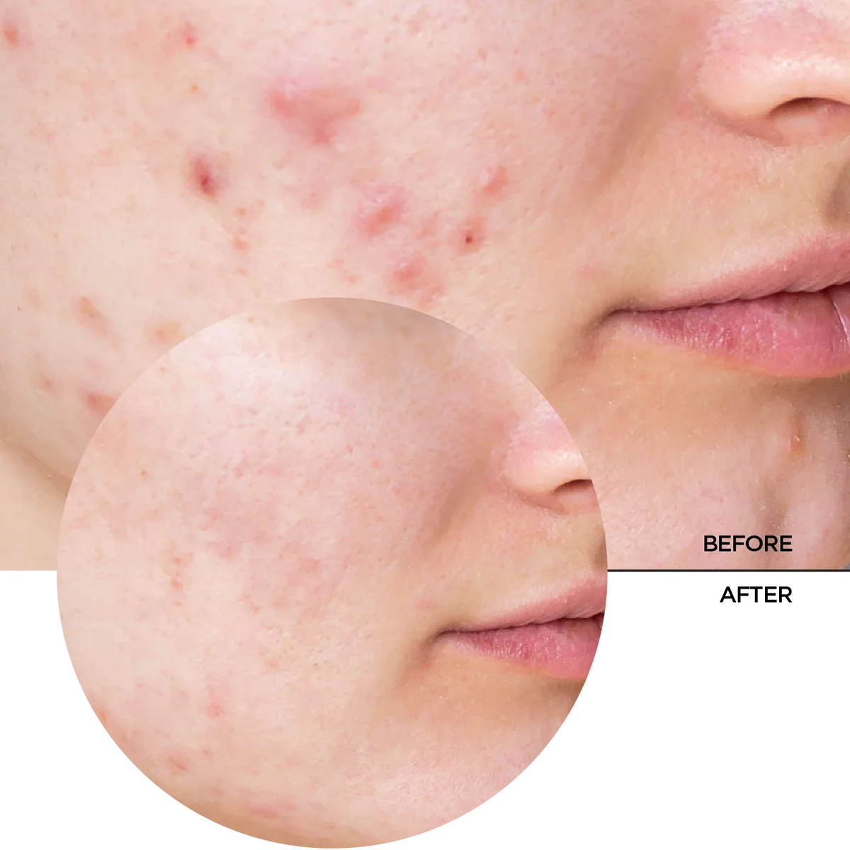 Revox B77 Just Niacinamide 10% Daily Moisturiser 30Ml