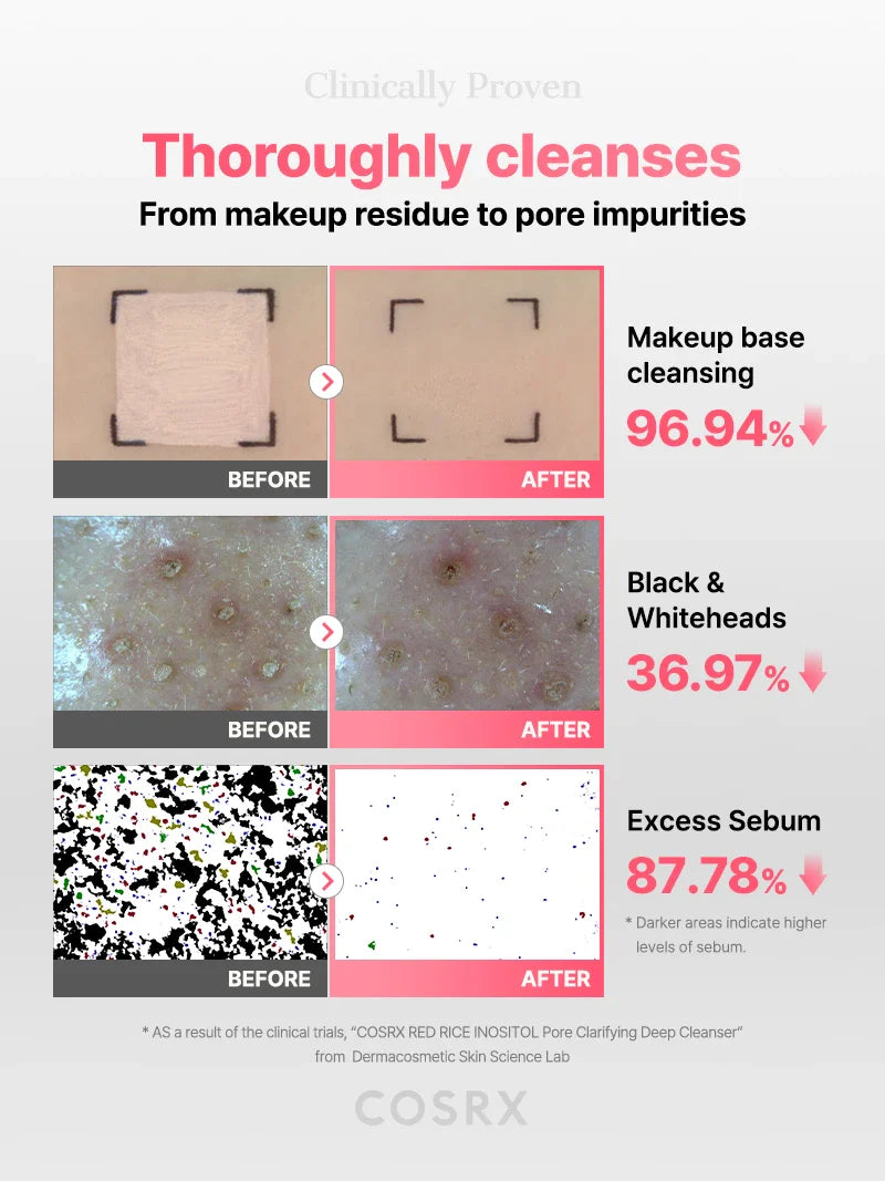 Cosrx Red Rice Inositol Pore Clarifying Deep Cleanser 150Ml