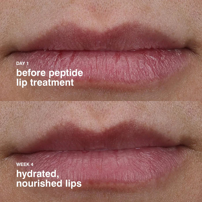 Rhode Lip Treatment Vanilla 10Ml